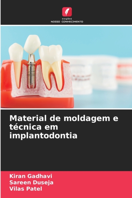 Material de moldagem e tecnica em implantodontia, Paperback / softback Book