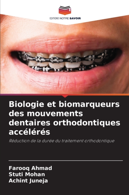 Biologie et biomarqueurs des mouvements dentaires orthodontiques acceleres, Paperback / softback Book