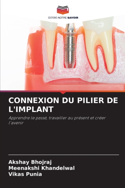 Connexion Du Pilier de l'Implant, Paperback / softback Book