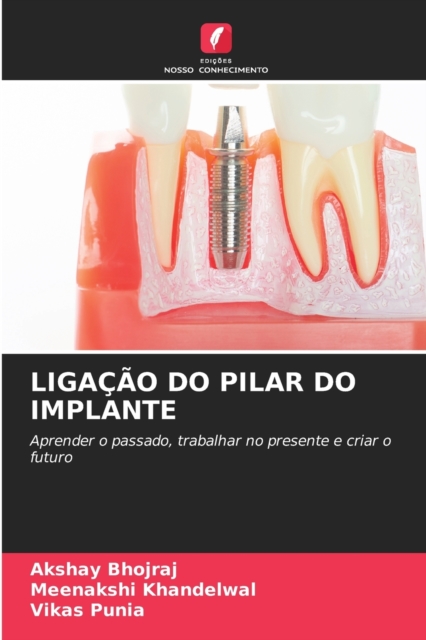 Ligacao Do Pilar Do Implante, Paperback / softback Book