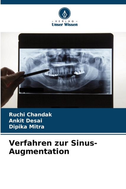 Verfahren zur Sinus-Augmentation, Paperback / softback Book