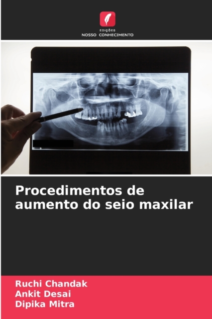 Procedimentos de aumento do seio maxilar, Paperback / softback Book