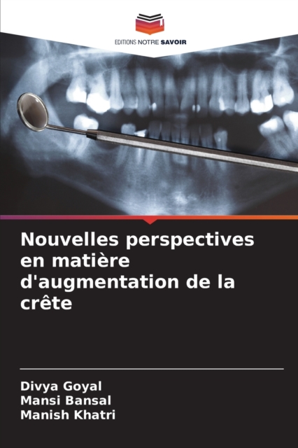 Nouvelles perspectives en matiere d'augmentation de la crete, Paperback / softback Book