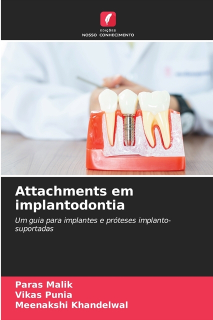 Attachments em implantodontia, Paperback / softback Book