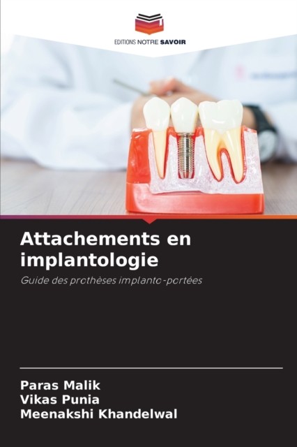 Attachements en implantologie, Paperback / softback Book