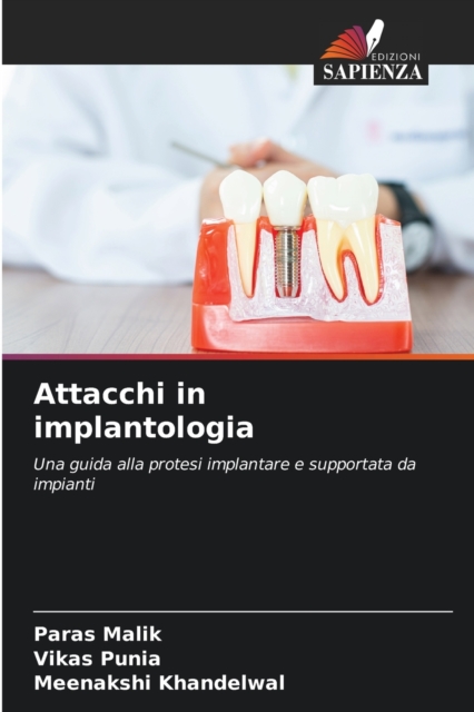 Attacchi in implantologia, Paperback / softback Book