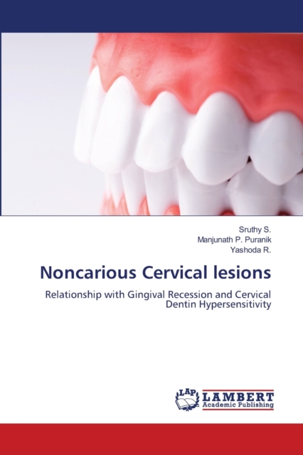 Noncarious Cervical lesions, Paperback / softback Book