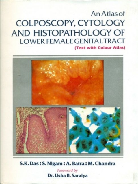 An Atlas of Colposcopy, Cytology & Histopathology of Lower Female Genital Tract : Text with Colour Atlas, Hardback Book