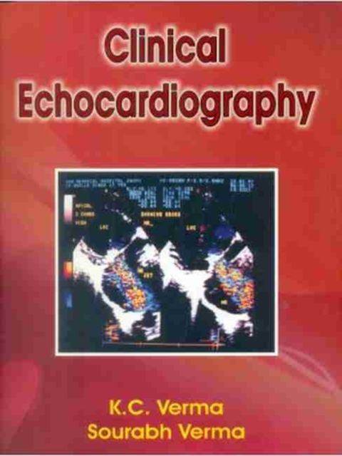 Clinical Echocardiography, Hardback Book