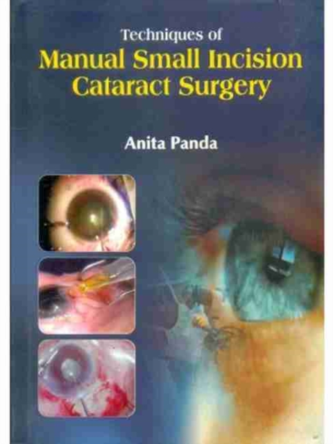 Techniques of Manual Small Incision Cataract Surgery, Hardback Book