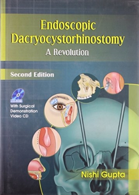 Endoscopic Dacryocystorhinostomy, Hardback Book