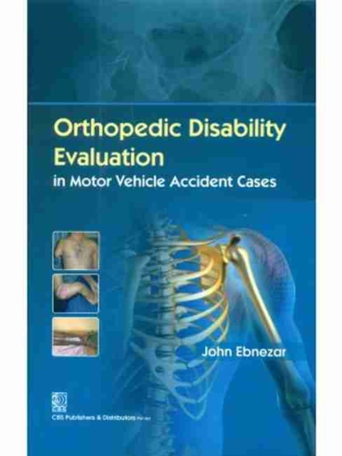 Orthopedic Disability Evaluation in Motor Vehicle Accident Cases, Hardback Book