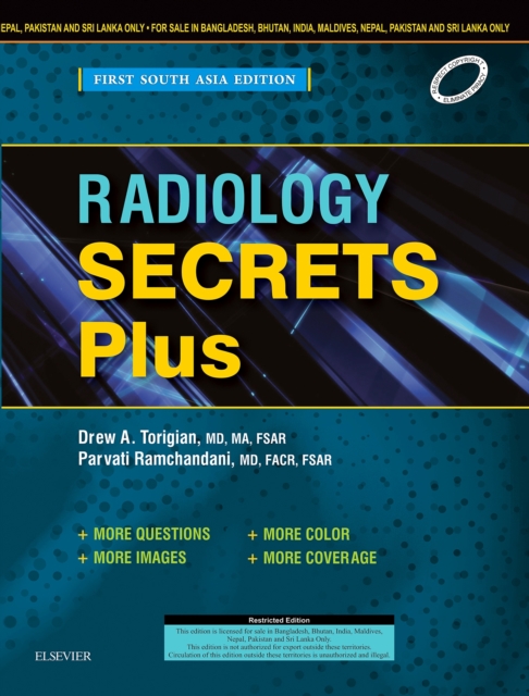 Radiology Secrets: First South Asia Edition - Ebook, PDF eBook