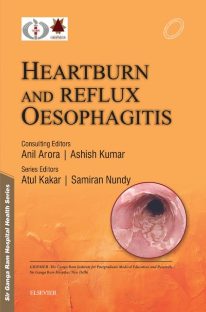 Sir Ganga Ram Hospital Health Series: Heartburn and Reflux Oesophagitis - e-book, EPUB eBook