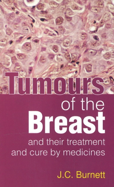 Tumours of the Breast : & Their Treatment & Cure by Medicines, Paperback / softback Book