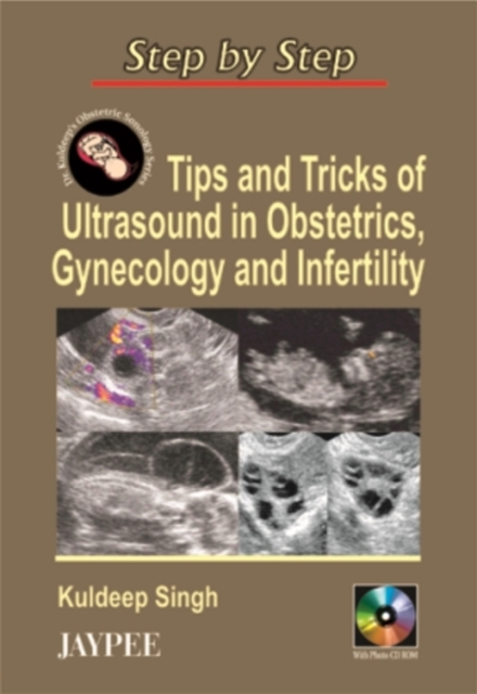 Step by Step: Tips & Tricks of Ultrasound in Obstetrics, Gynecology & Infertility, Paperback / softback Book