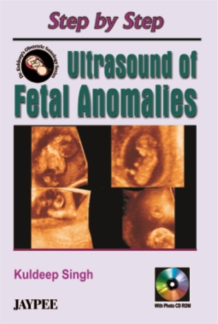 Step by Step Ultrasound of Fetal Anomalies, Paperback / softback Book
