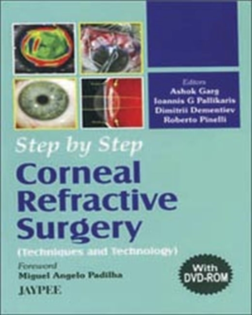 Step by Step: Corneal Refractive Surgery, Mixed media product Book