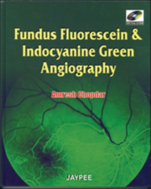 Fundus Fluorescien and Indocyanine Green Angiography, Mixed media product Book