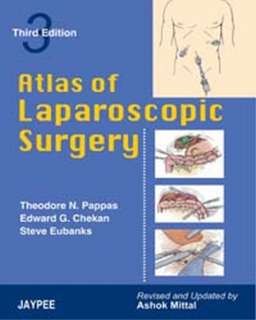 Atlas of Laparoscopic Surgery, Paperback / softback Book