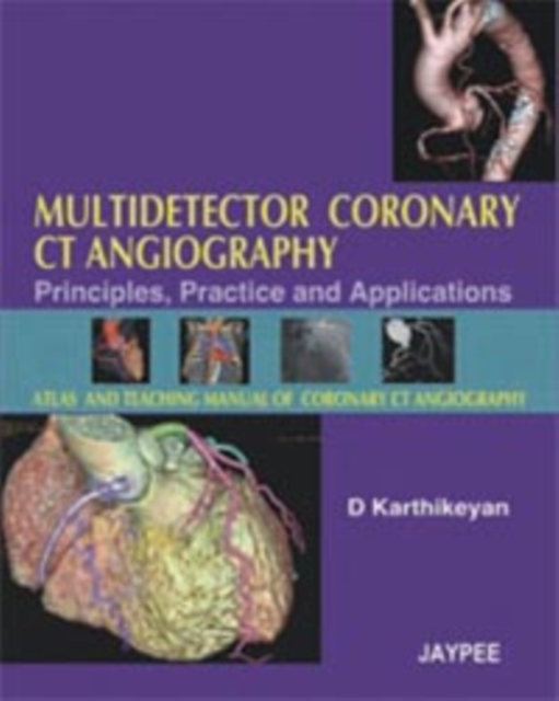 Multidetector Coronary CT Angiography : Principles, Practice and Applications, Hardback Book