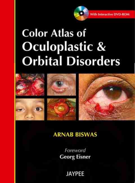 Color Atlas of Oculoplastic & Orbital Disorders, Multiple-component retail product Book