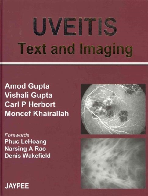 UVEITIS Text and Imaging, Hardback Book