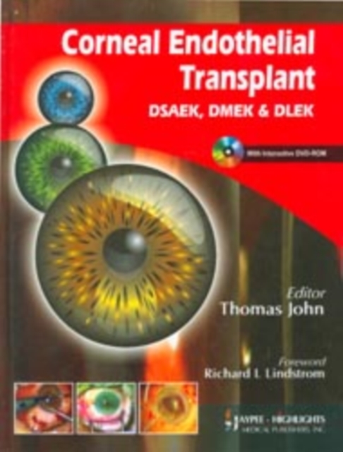 Corneal Endothelial Transplant DSEAK, DMEK and DLEK, Multiple-component retail product Book