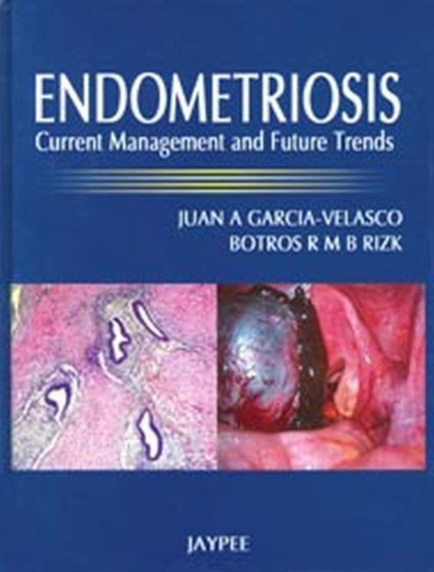 Endometriosis : Current Management and Future Trends, Hardback Book