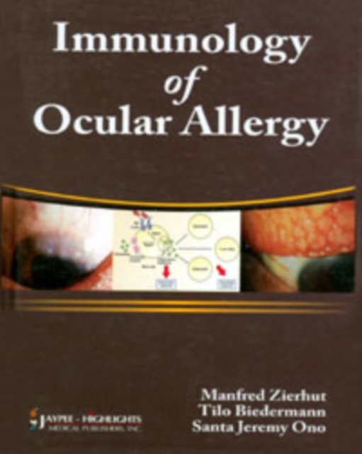 Immunology of Ocular Allergy, Hardback Book