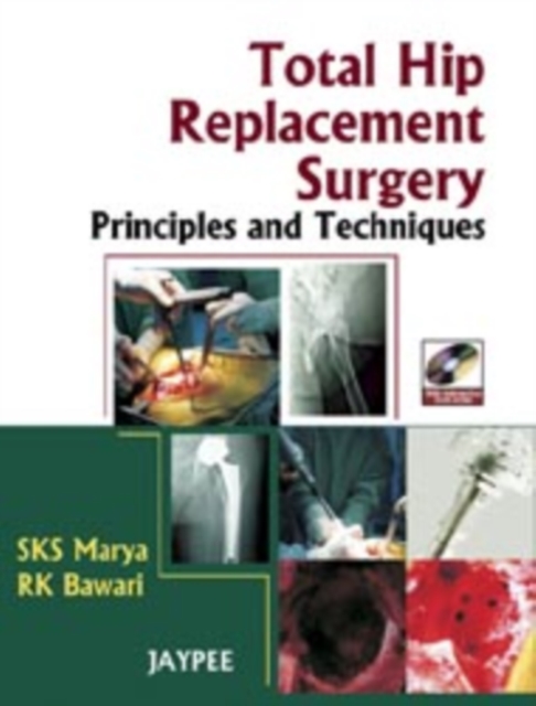Total Hip Replacement Surgery : Principles and Techniques, Mixed media product Book