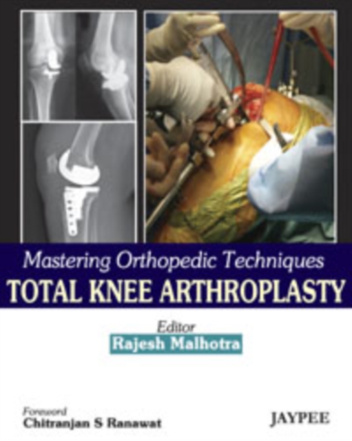 Mastering Orthopedic Techniques: Total Knee Arthroplasty, Hardback Book