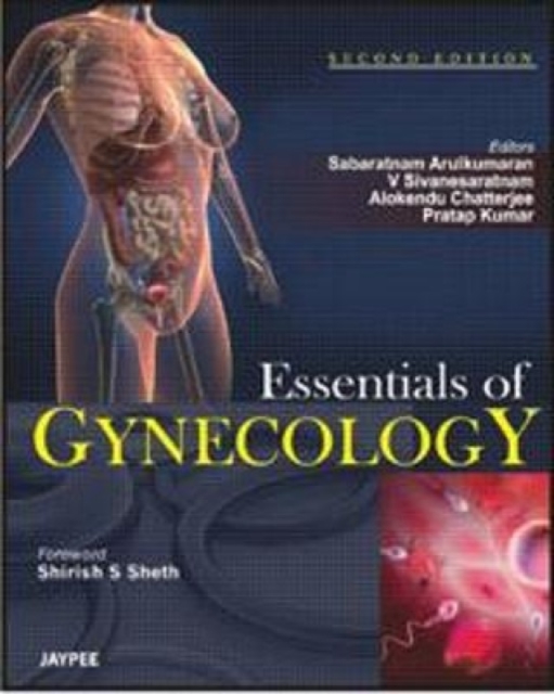 Essentials of Gynecology, Paperback / softback Book