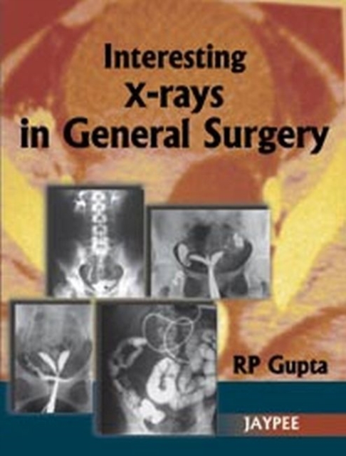 Interesting X-Rays in General Surgery, Paperback / softback Book