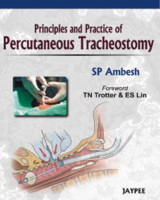 Principles and Practice of Percutaneous Tracheostomy, Hardback Book