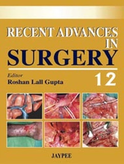 Recent Advances in Surgery - 12, Paperback / softback Book
