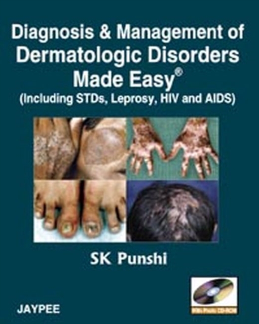 Diagnosis and Management of Dermatologic Disorders Made Easy : Including STDs, Leprosy, HIV and AIDs, Paperback Book