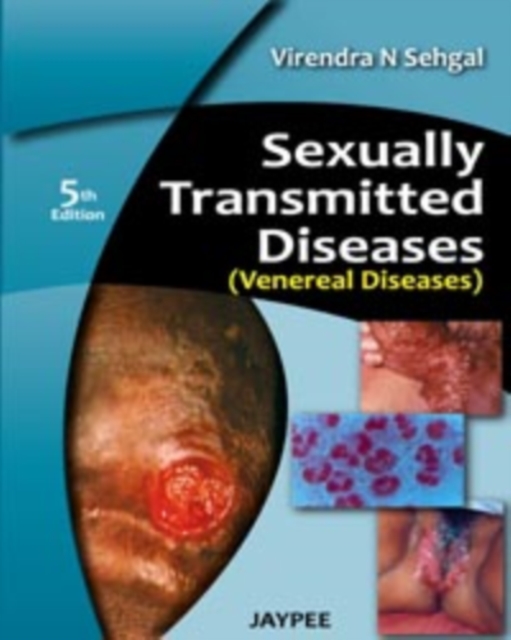 Sexually Transmitted Diseases (Venereal Diseases), Paperback / softback Book