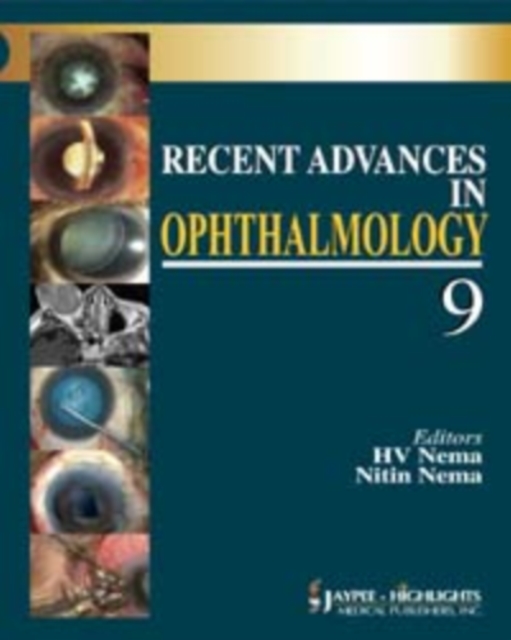 Recent Advances in Ophthalmology - 9, Hardback Book