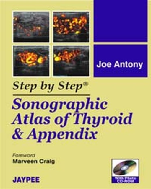 Step by Step: Sonographic Atlas of Thyroid and Appendix, Paperback / softback Book