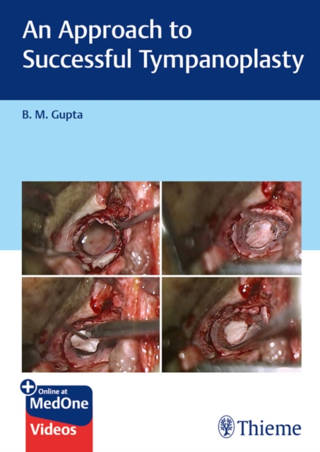 An Approach to Successful Tympanoplasty, EPUB eBook