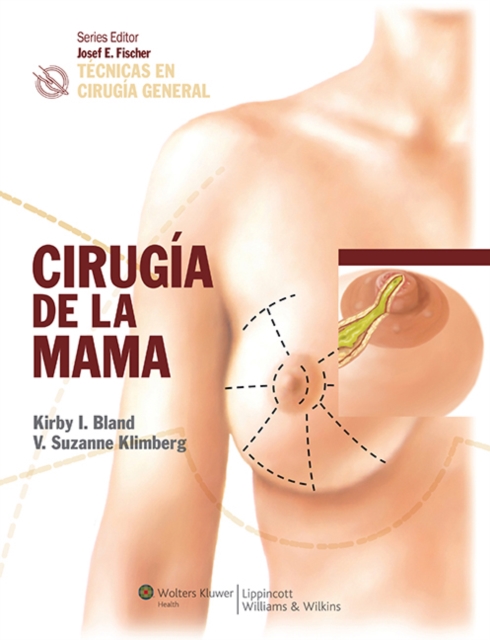 Tecnicas en cirugia general: Cirugia de la mama, Hardback Book