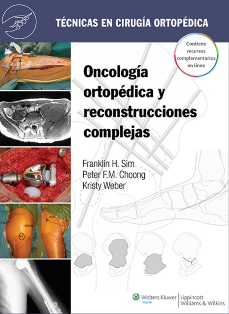 Tecnicas en cirugia ortopedica. Oncologia ortopedica y reconstrucciones complejas, Hardback Book