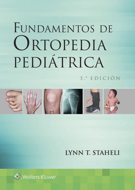 Fundamentos de ortopedia pediatrica, Paperback / softback Book