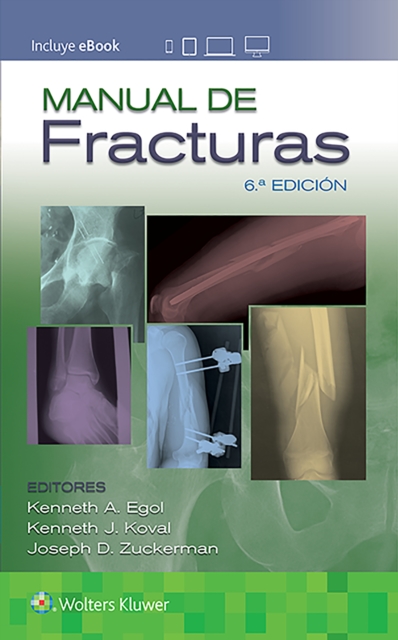 Manual de fracturas, Paperback / softback Book