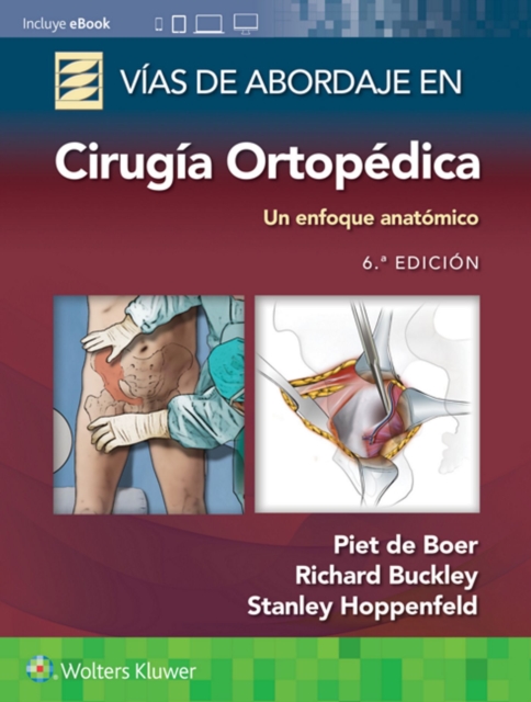 Vias de abordaje de cirugia ortopedica. Un enfoque anatomico, Paperback / softback Book