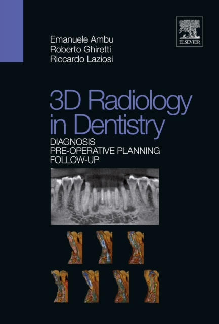 3D Radiology in Dentistry : Diagnosis Pre-operative Planning Follow-up, EPUB eBook