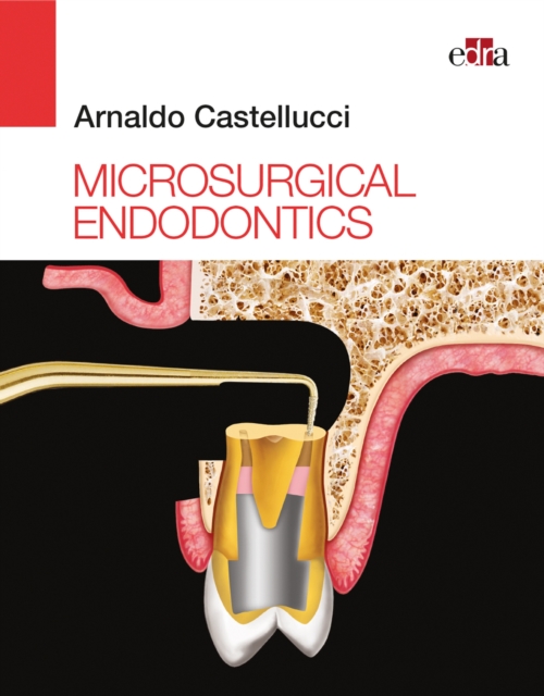 Microsurgical Endodontics, EPUB eBook