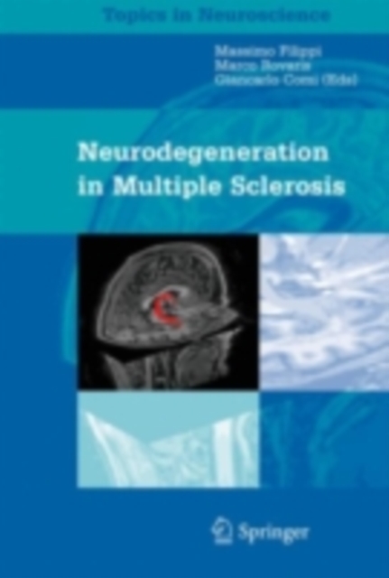 Neurodegeneration in Multiple Sclerosis, PDF eBook