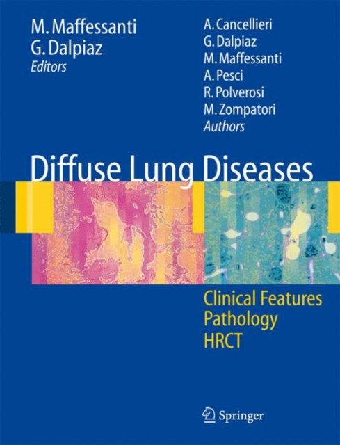 Diffuse Lung Diseases : Clinical Features, Pathology, HRCT, Paperback / softback Book